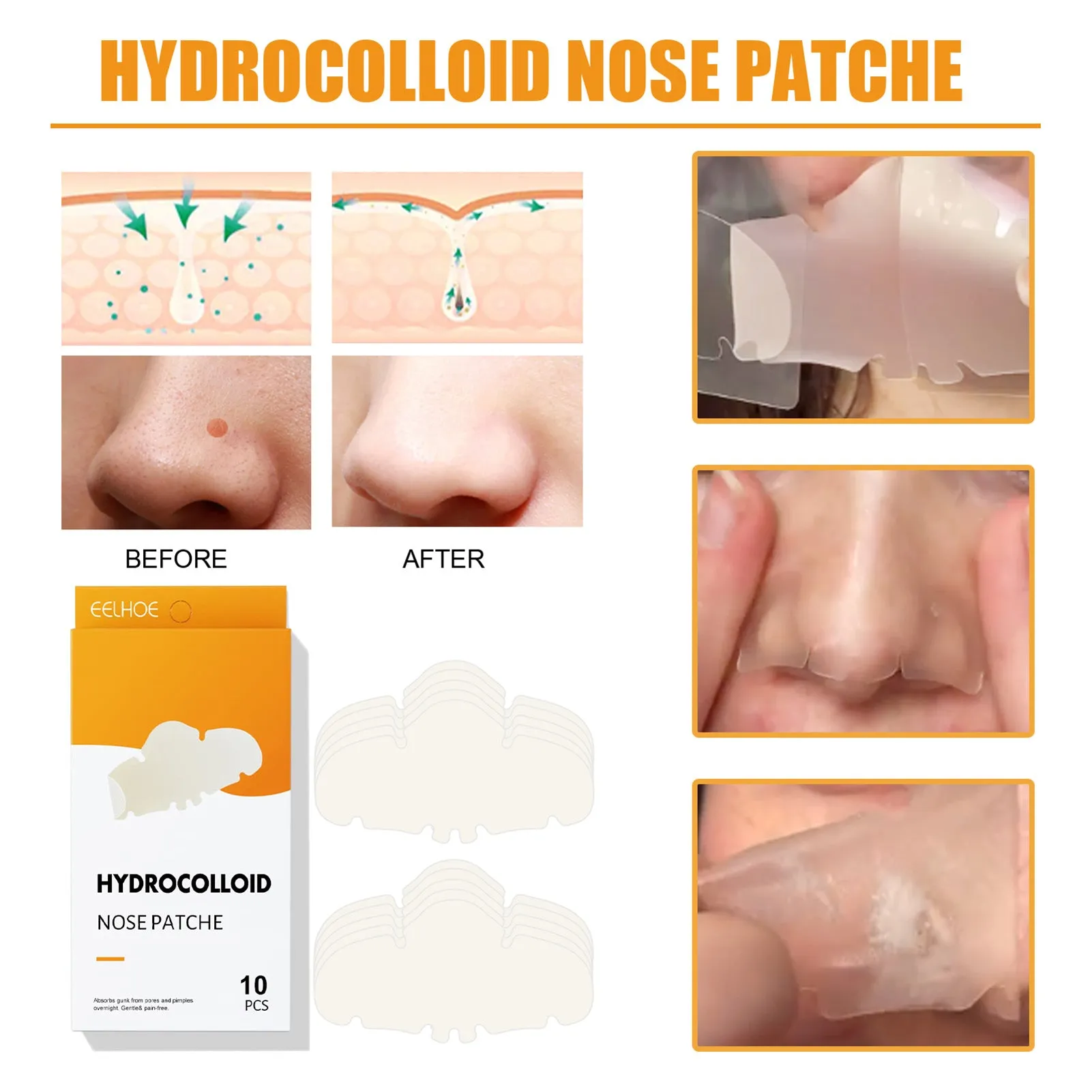 EELHOE Hydrocolloid Nose Patches